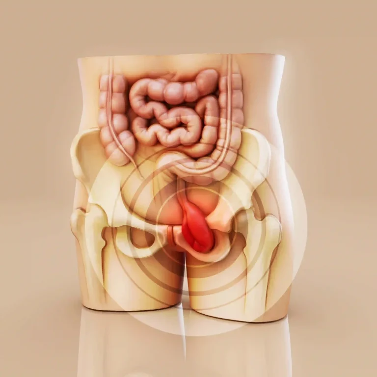 apandisit-ameliyatı-bursa